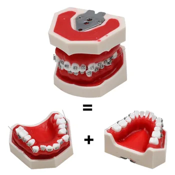 Ортодонтическая модел на зъбите с брекетами Модел на зъбите за изследвания в стоматологична клиника, Зъболекарски инструмент